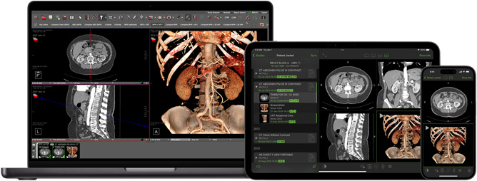 O software exibe o app Visage, usado pelos radiologistas para interpretar grandes arquivos de diagnóstico.